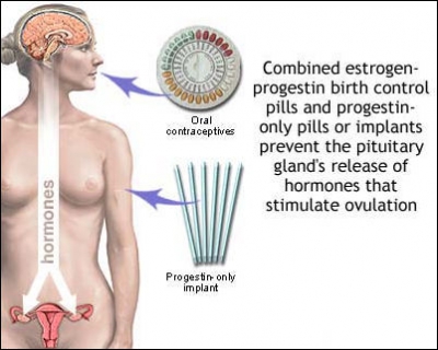 Равнение - на Запад!